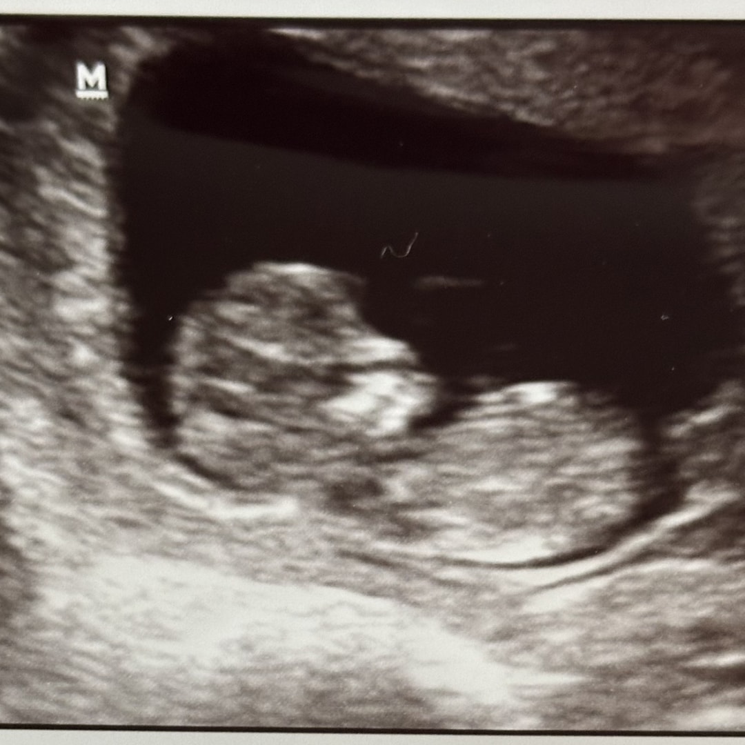 Photo shared by Valerie for their Babylist baby registry.