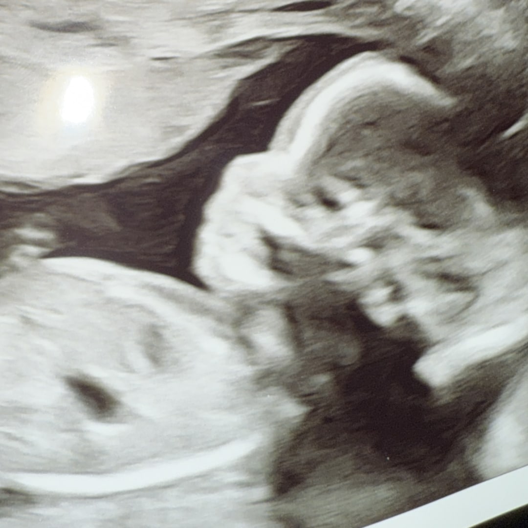 Photo shared by Anika for their Babylist baby registry.