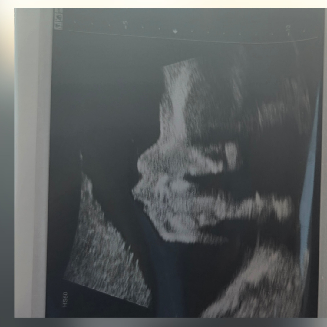 Photo shared by Bryanna for their Babylist baby registry.