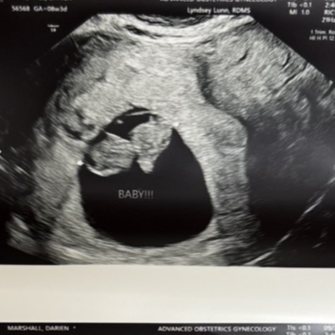 Photo shared by Darien for their Babylist baby registry.