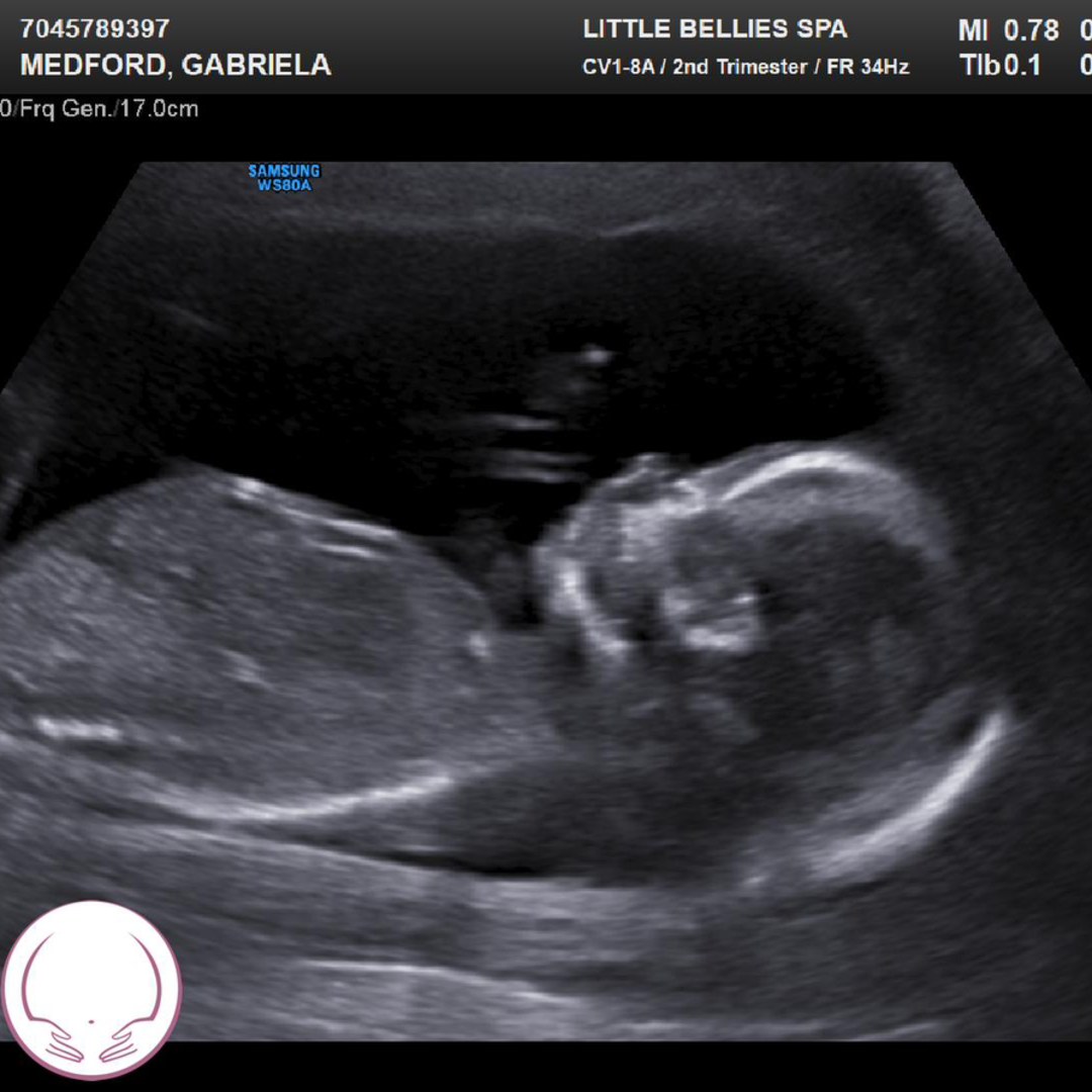 Photo shared by Gabriela for their Babylist baby registry.