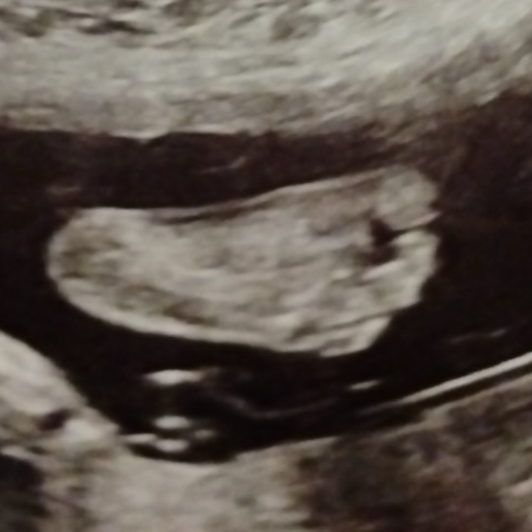 Photo shared by Laura for their Babylist baby registry.