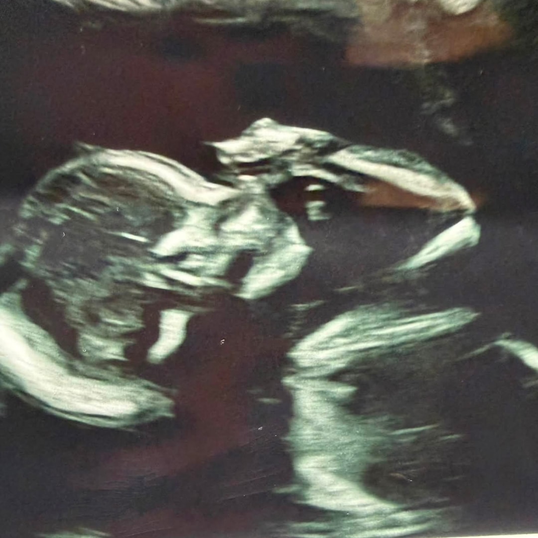 Photo shared by Jshanna for their Babylist baby registry.