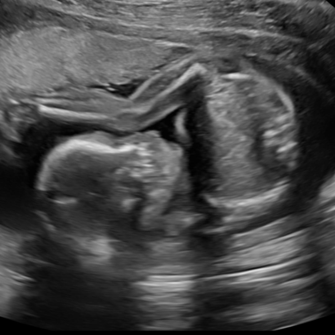 Photo shared by Julie for their Babylist baby registry.