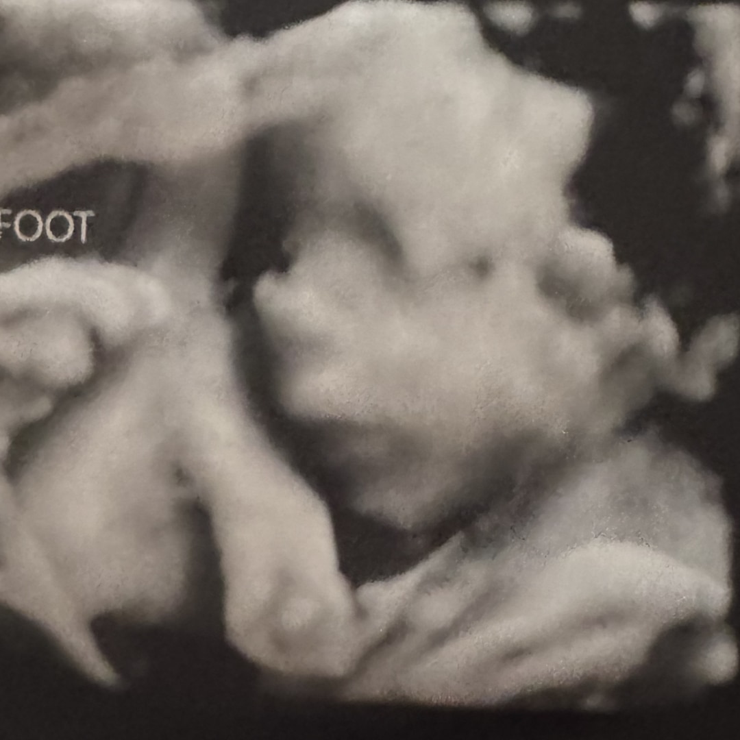 Photo shared by Katie for their Babylist baby registry.