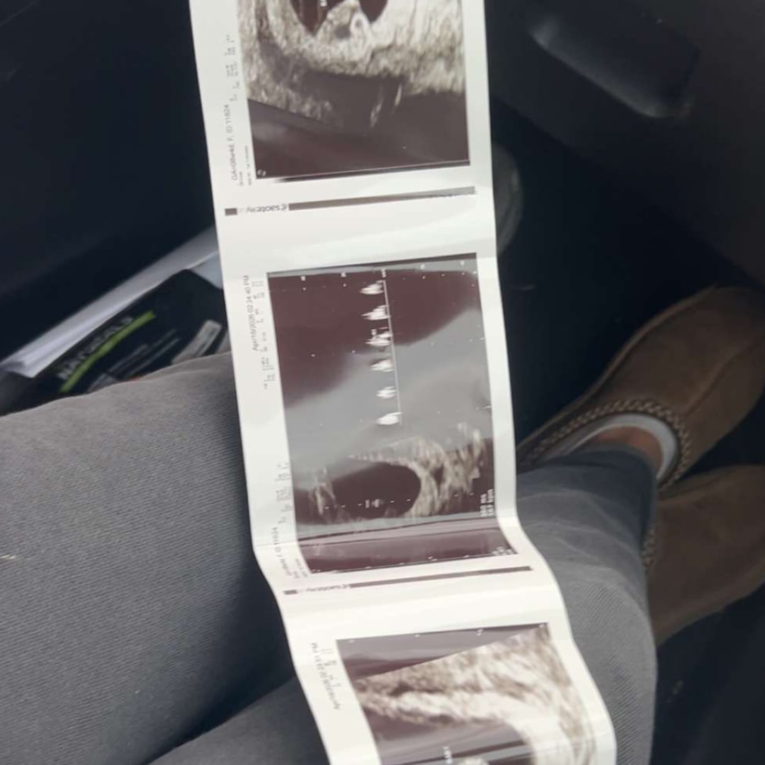Photo shared by Madelynn for their Babylist baby registry.