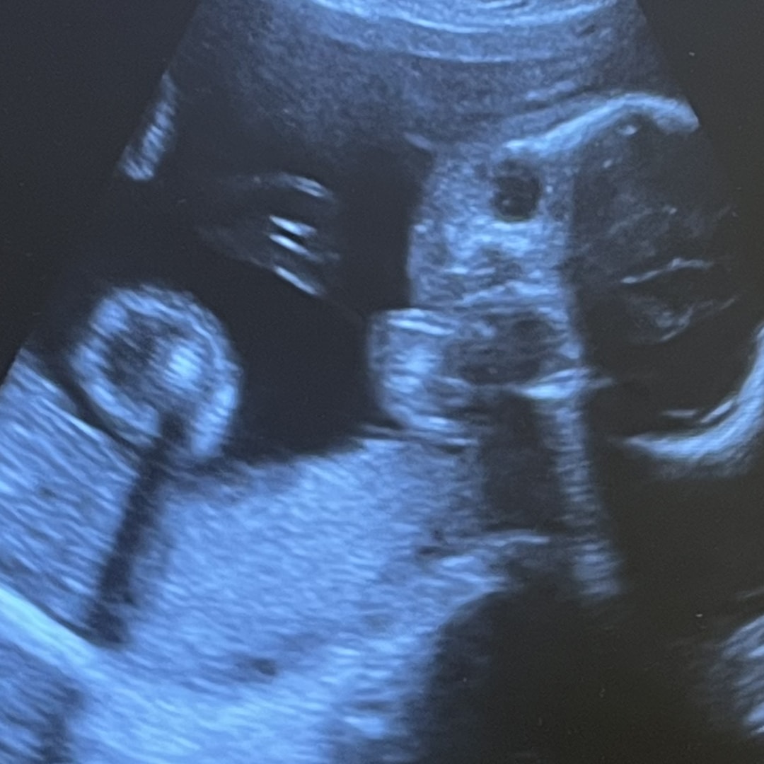 Photo shared by Bridget for their Babylist baby registry.