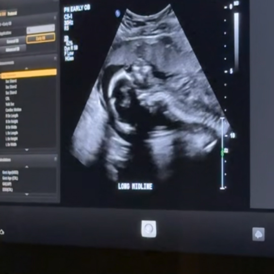 Photo shared by Brittany for their Babylist baby registry.