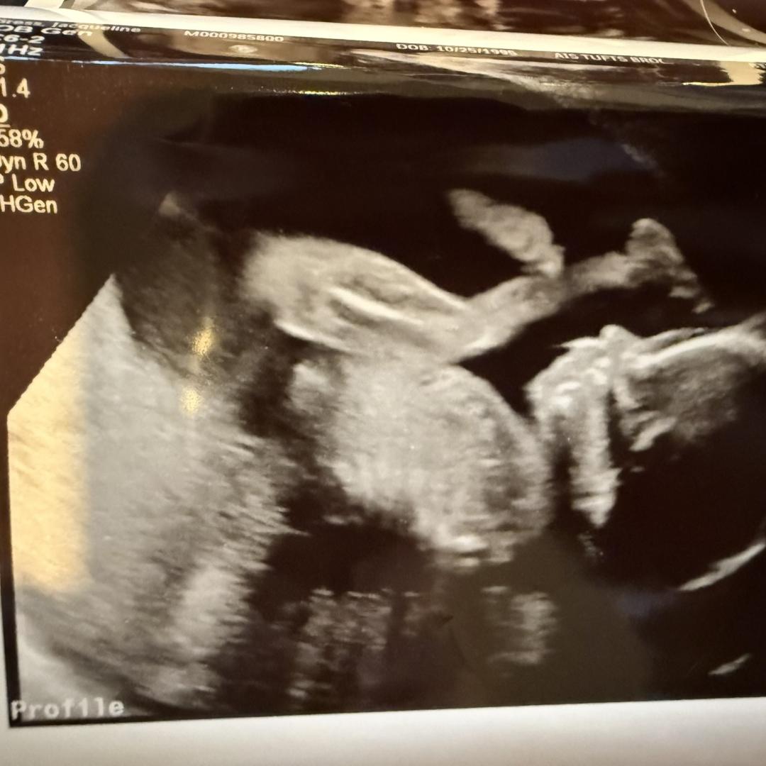 Photo shared by Jacqueline for their Babylist baby registry.