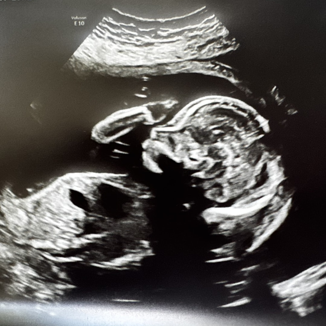 Photo shared by Rachael for their Babylist baby registry.