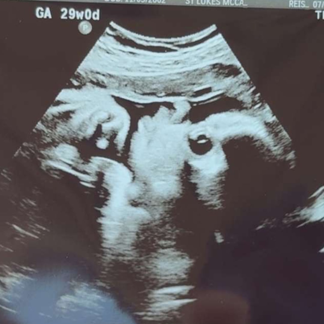 Photo shared by Kaydence for their Babylist baby registry.