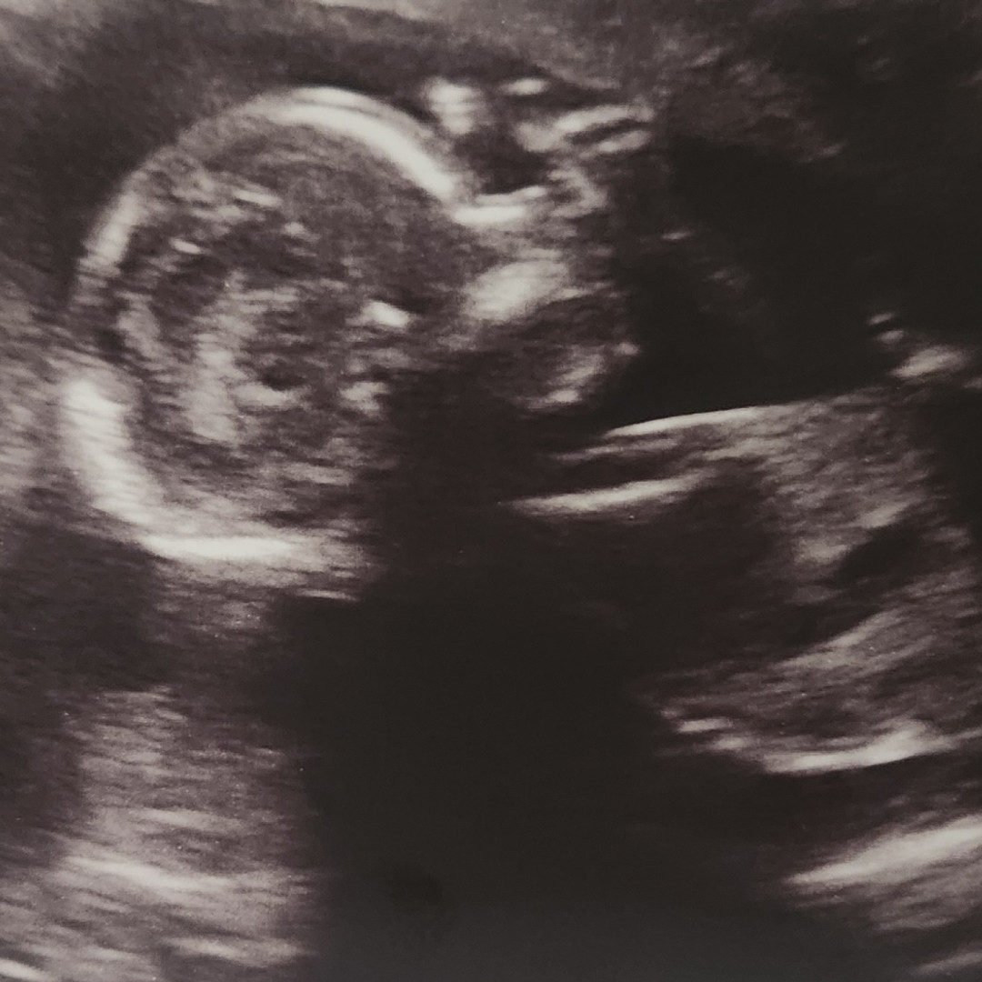 Photo shared by Acacia for their Babylist baby registry.