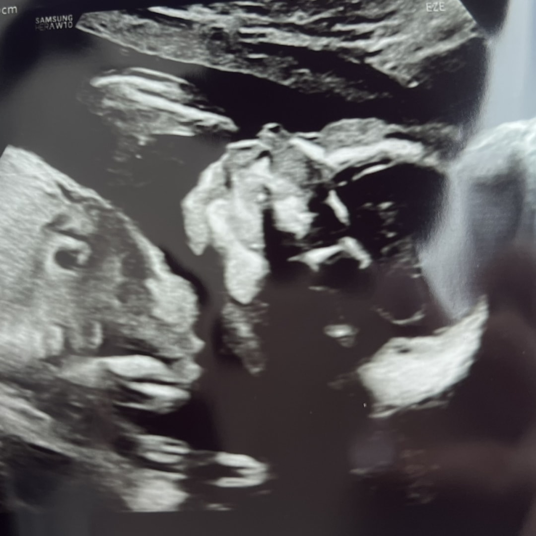 Photo shared by Caroline for their Babylist baby registry.