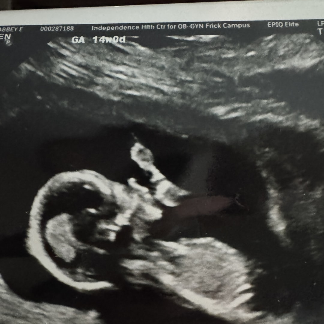 Photo shared by Abbey for their Babylist baby registry.