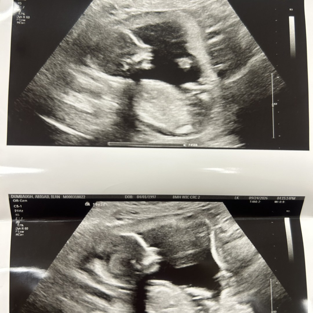 Photo shared by Abby for their Babylist baby registry.