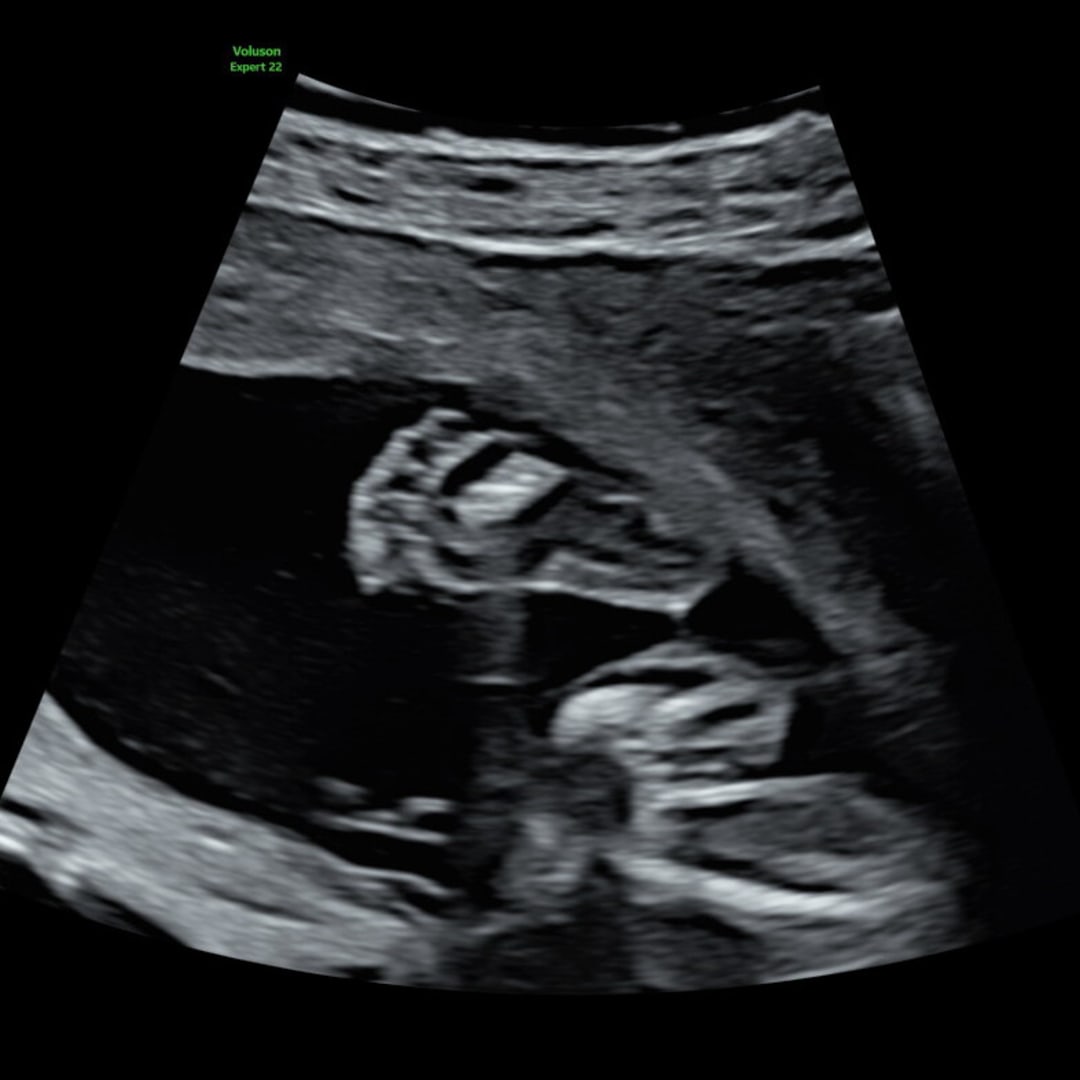 Photo shared by Ceilidhe for their Babylist baby registry.