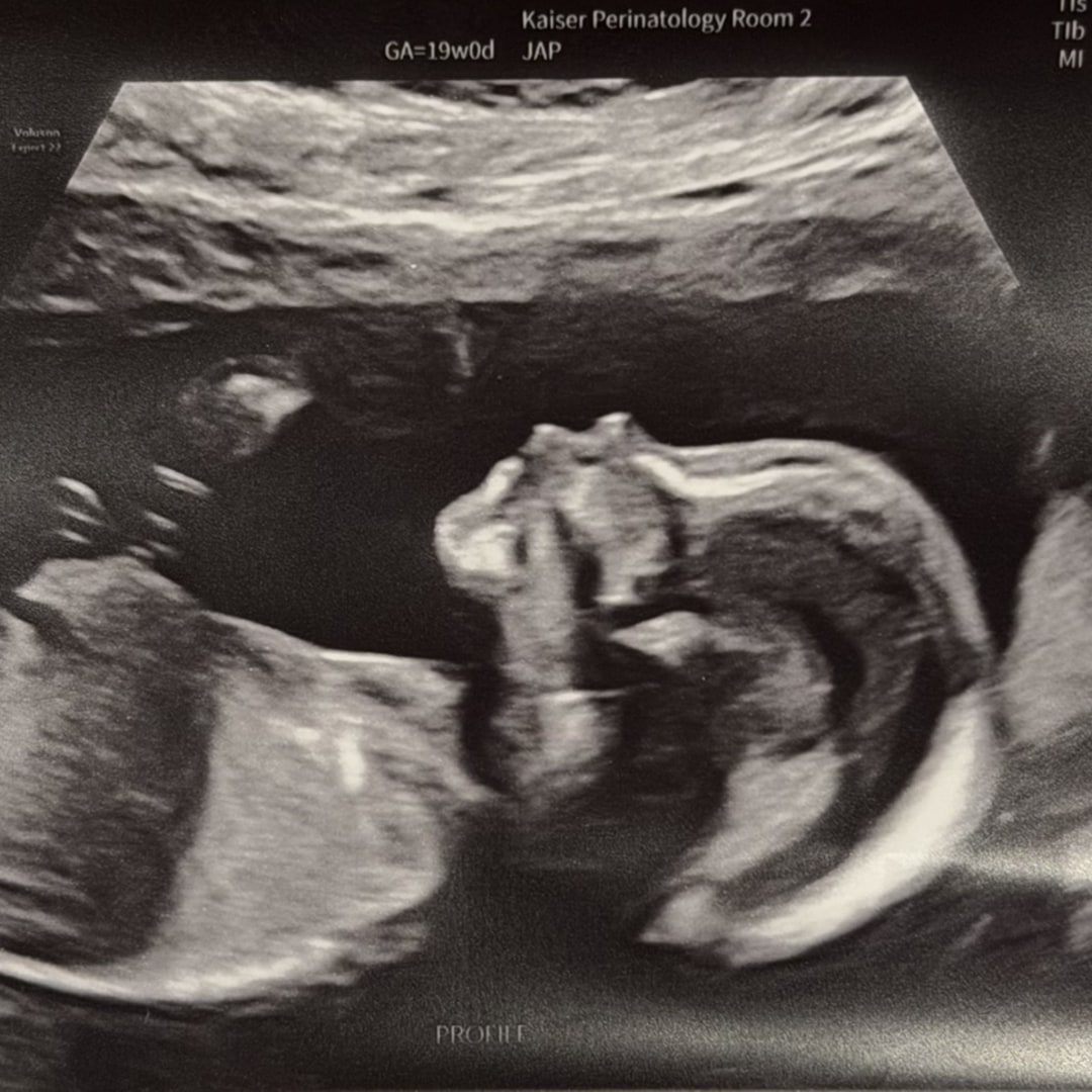 Photo shared by Kendall for their Babylist baby registry.