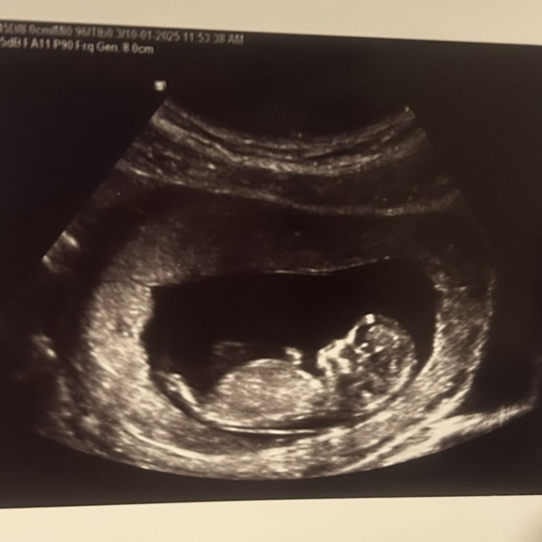 Photo shared by Katlyn for their Babylist baby registry.