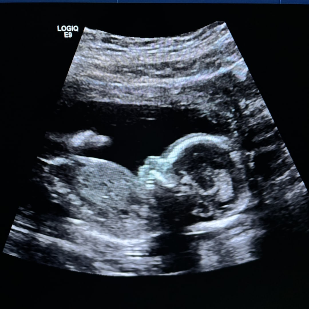 Photo shared by Melissa for their Babylist baby registry.