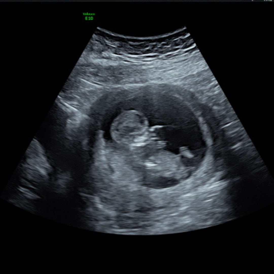 Photo shared by Desiree for their Babylist baby registry.