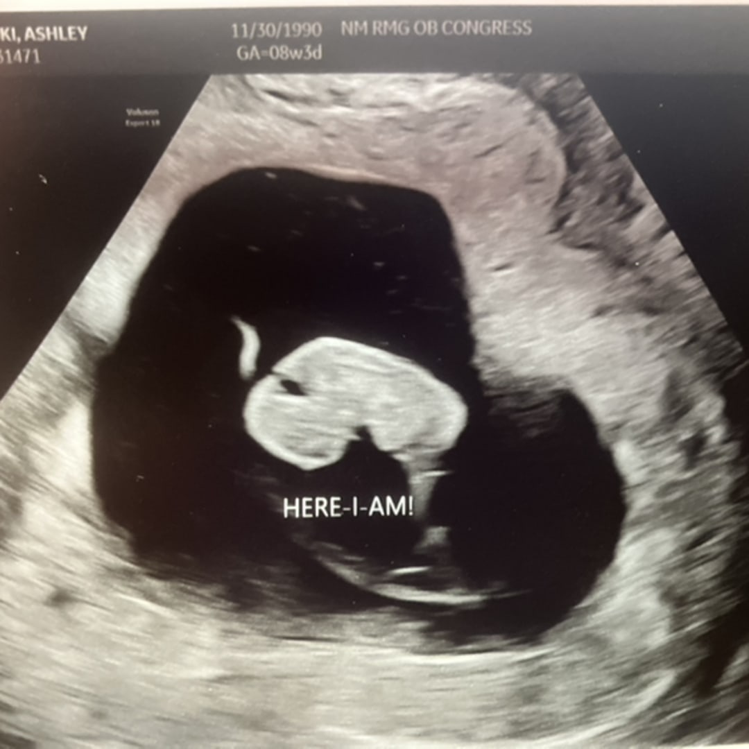 Photo shared by Ashley for their Babylist baby registry.