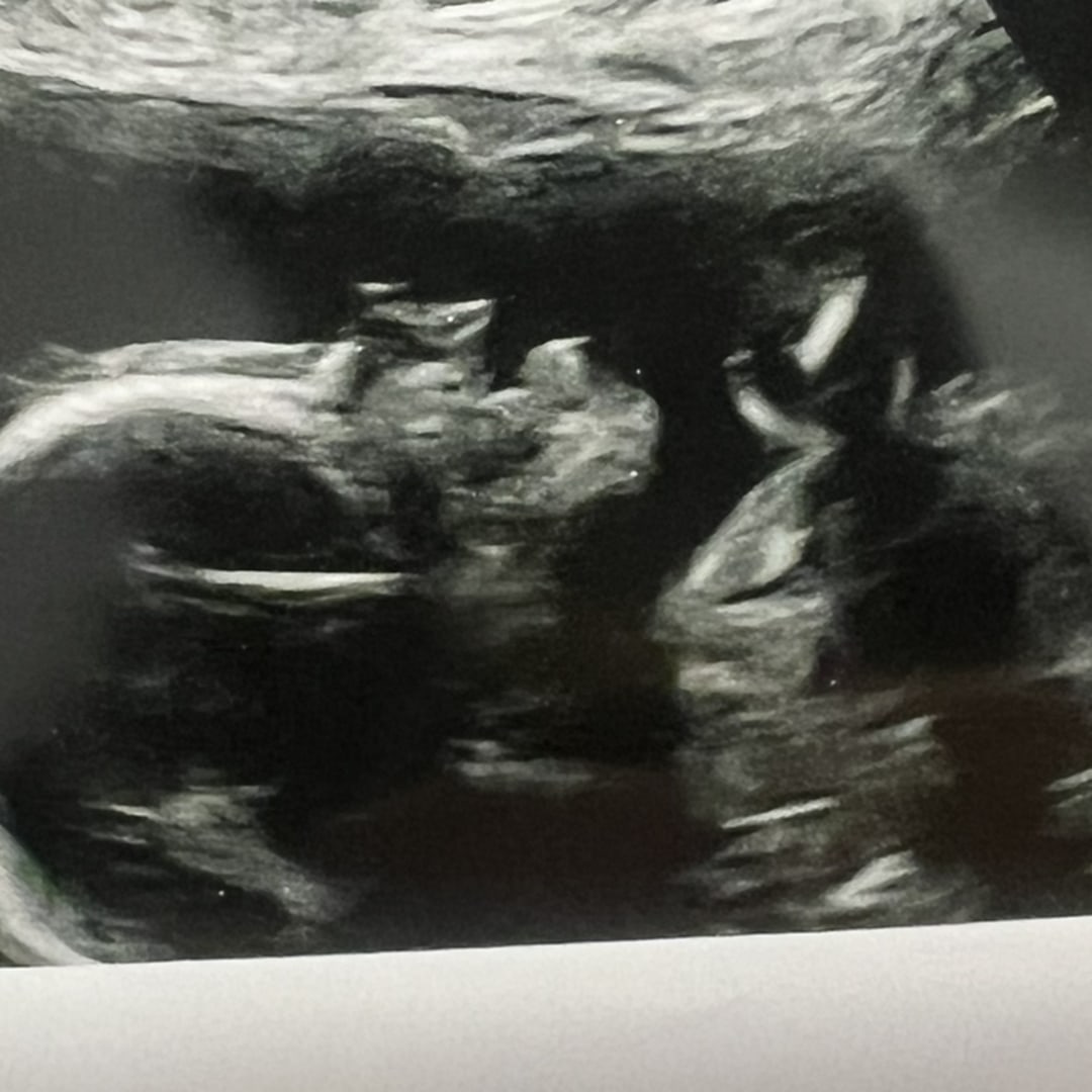 Photo shared by Ashley for their Babylist baby registry.