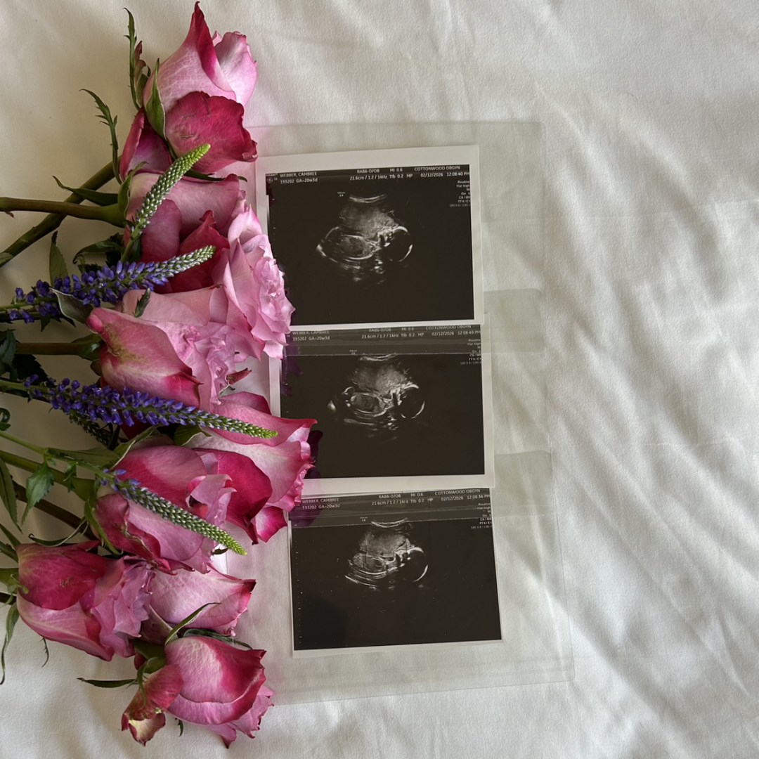 Photo shared by Cambree for their Babylist baby registry.