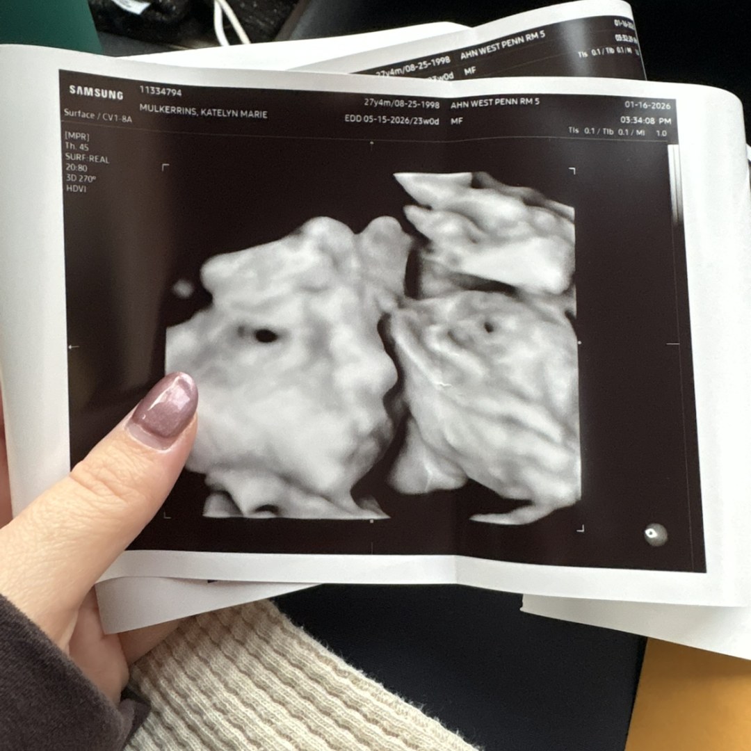 Photo shared by Katelyn for their Babylist baby registry.