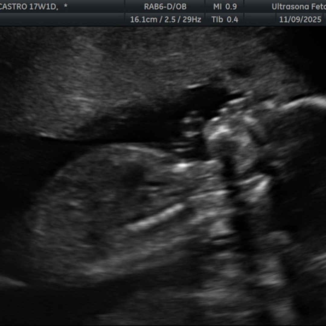 Photo shared by Hana for their Babylist baby registry.