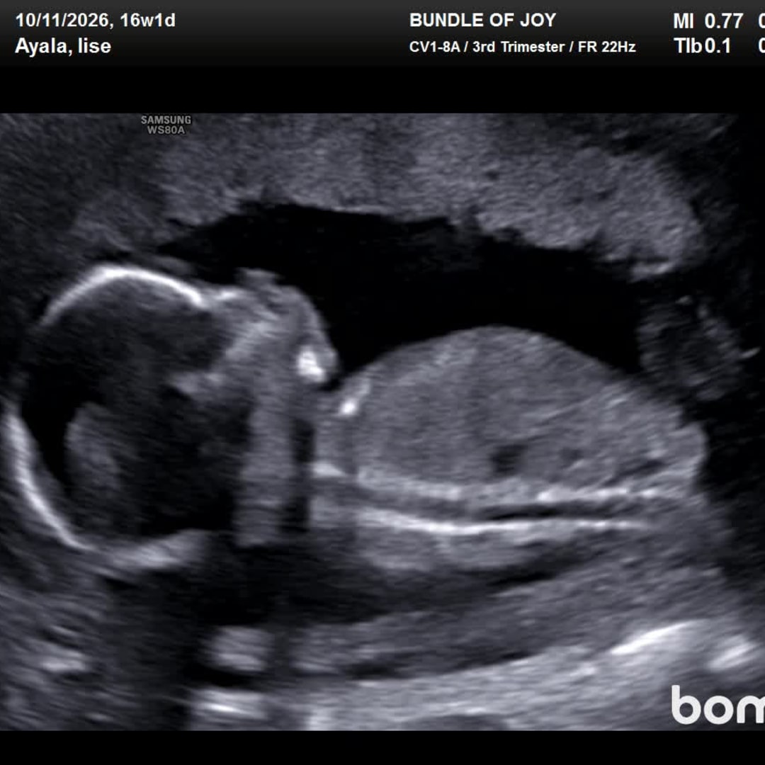 Photo shared by Ilse for their Babylist baby registry.