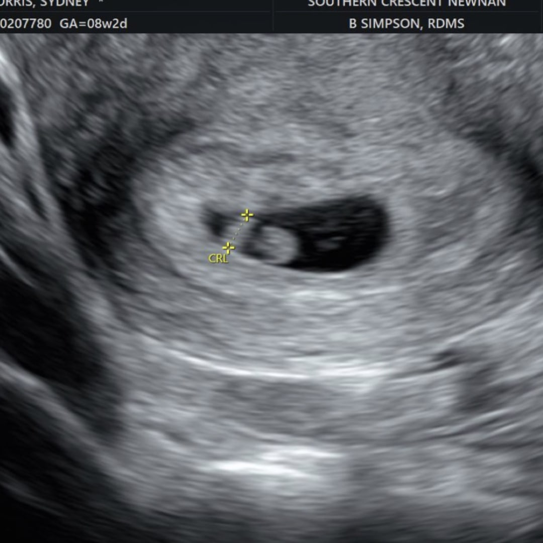 Photo shared by Sydney for their Babylist baby registry.