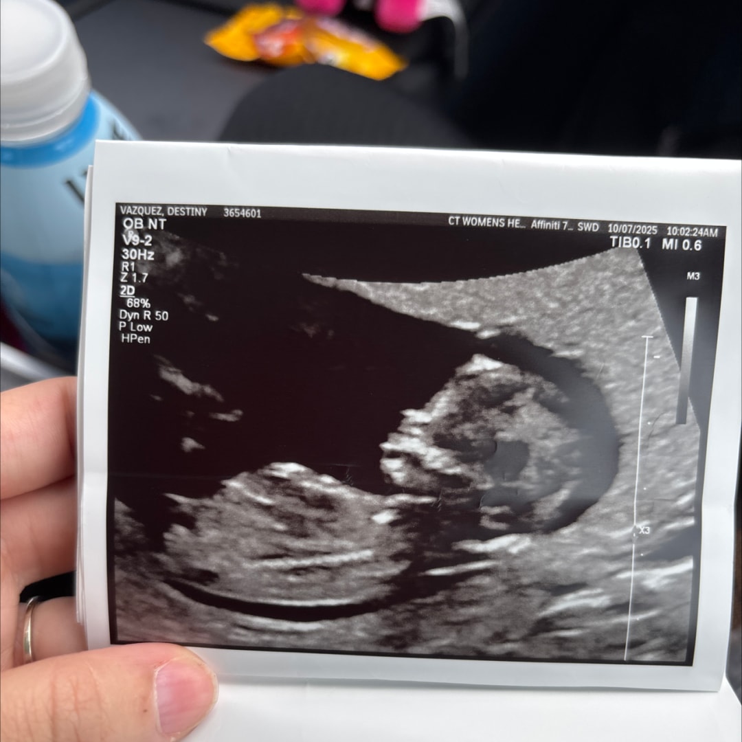 Photo shared by Destiny for their Babylist baby registry.