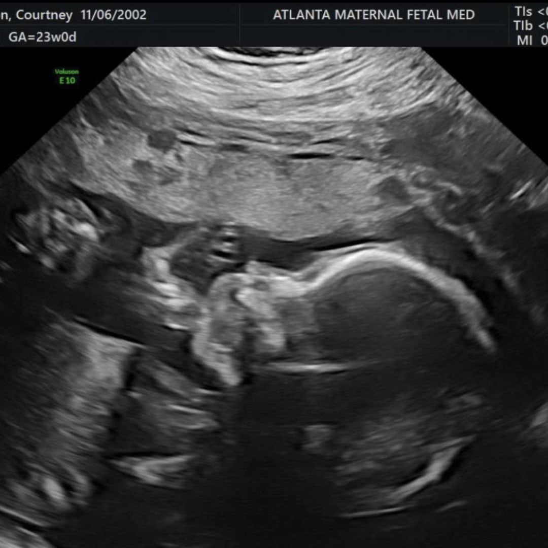 Photo shared by Courtney for their Babylist baby registry.