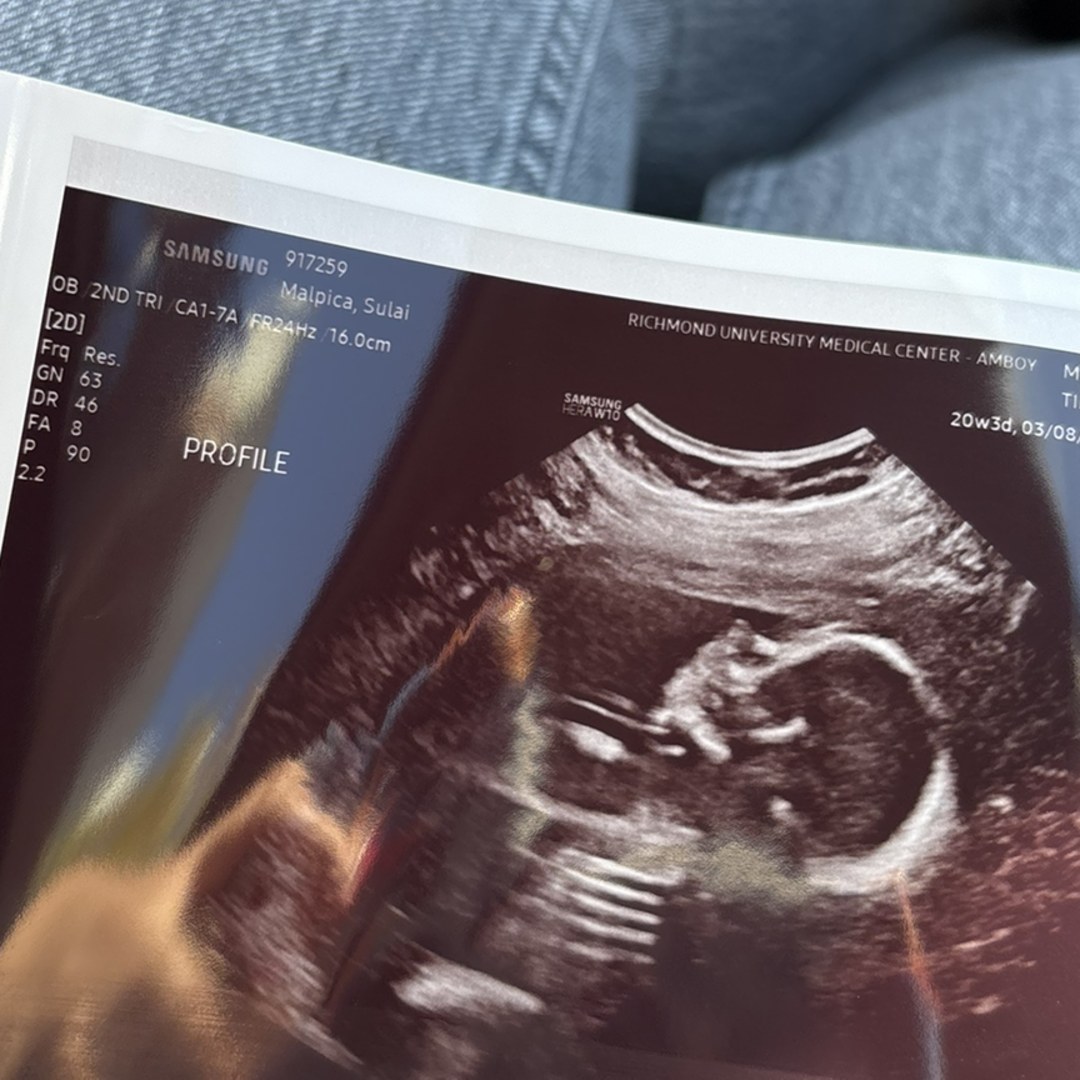 Photo shared by Sulai for their Babylist baby registry.