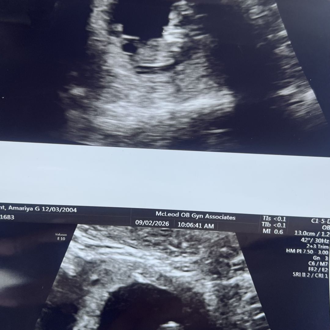 Photo shared by Amariya for their Babylist baby registry.