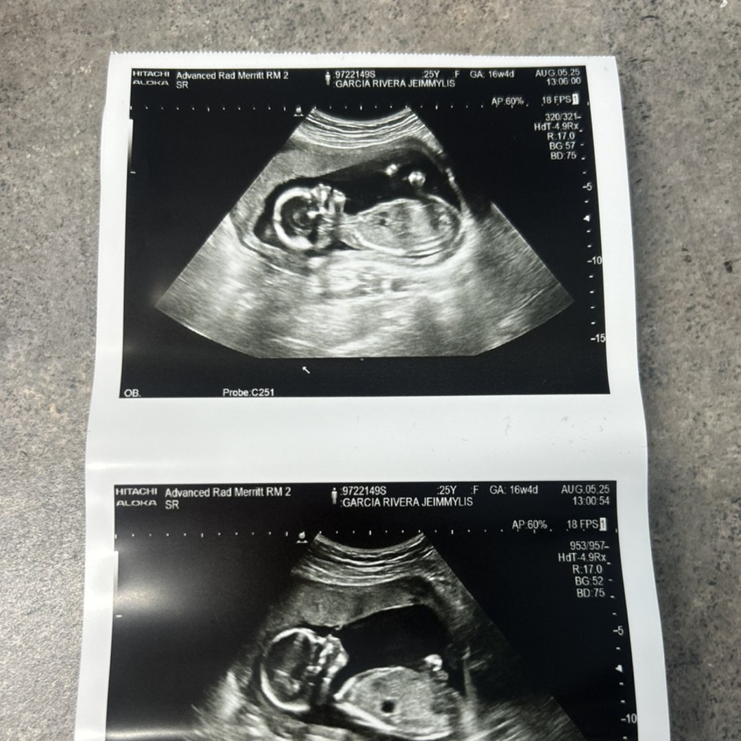 Photo shared by Jeimmylis for their Babylist baby registry.