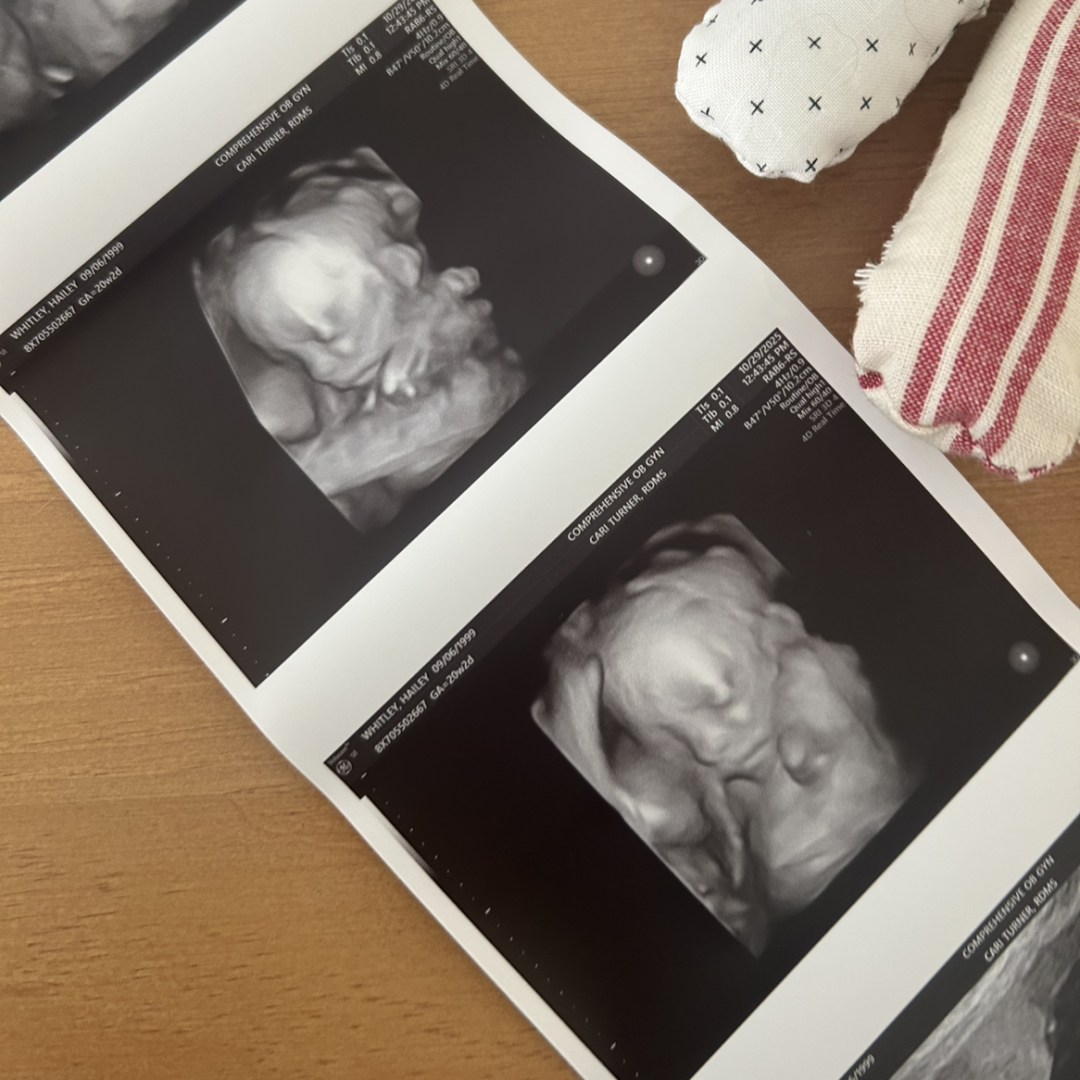 Photo shared by Hailey for their Babylist baby registry.