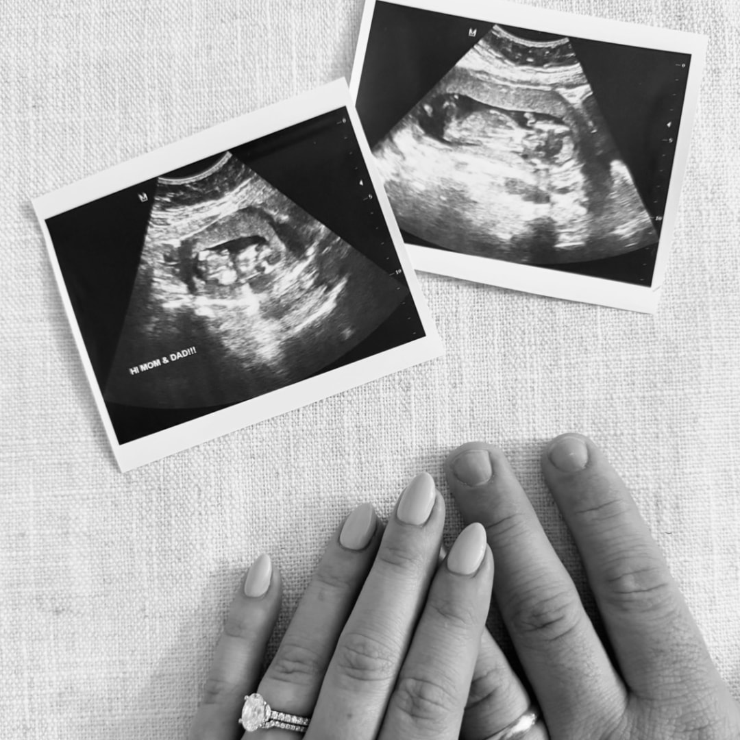 Photo shared by Zach & Sydney for their Babylist baby registry.