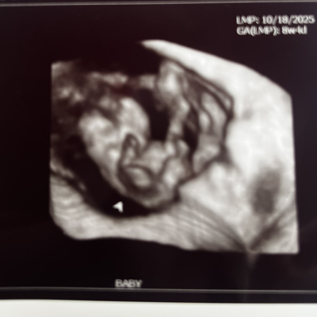 Photo shared by Kaci for their Babylist baby registry.