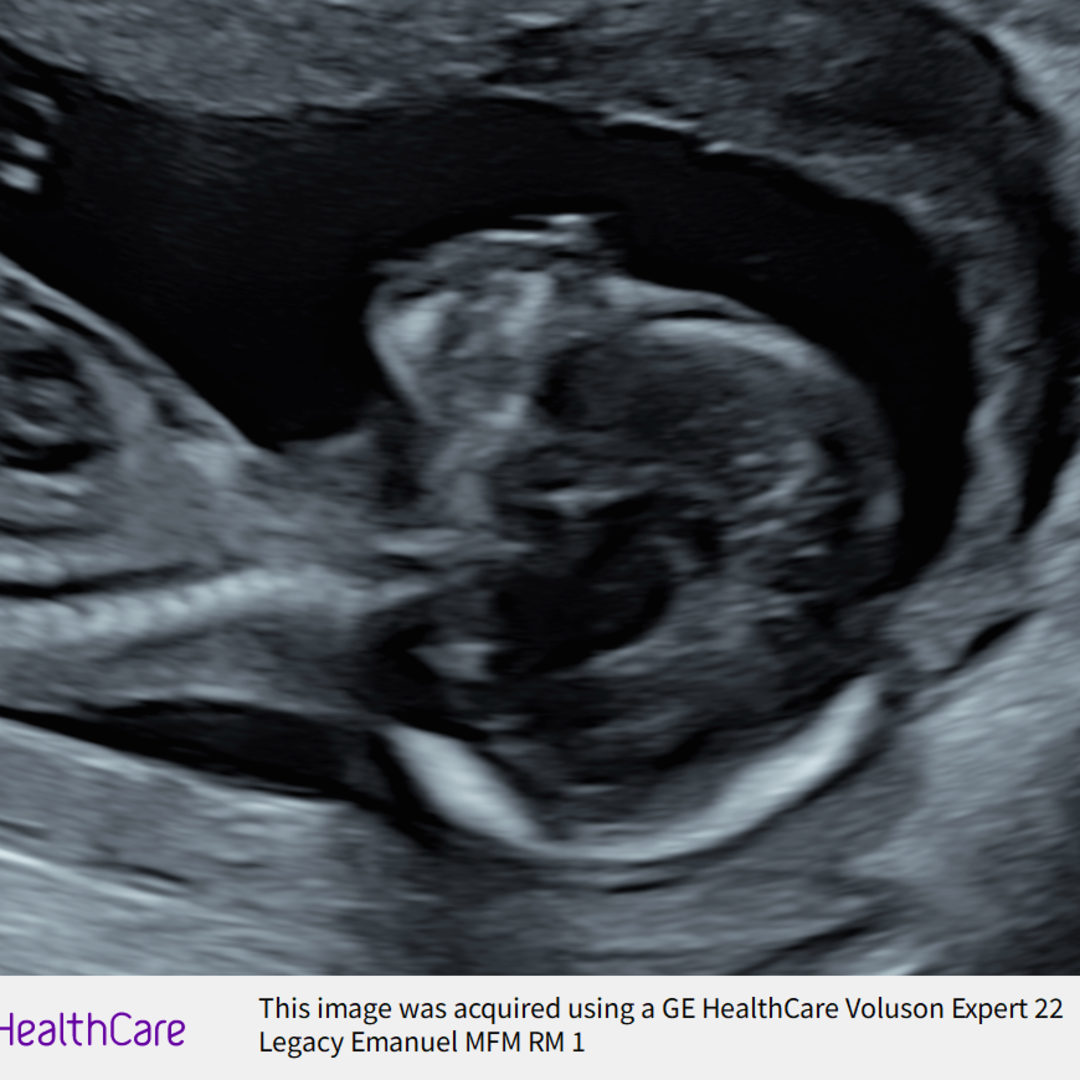Photo shared by Emily for their Babylist baby registry.