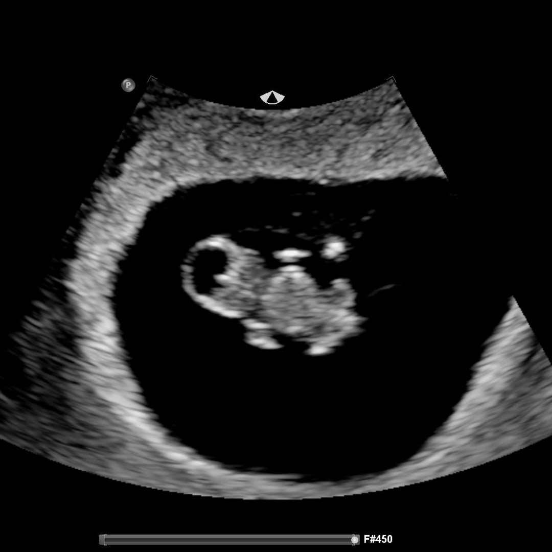 Photo shared by Lexi for their Babylist baby registry.