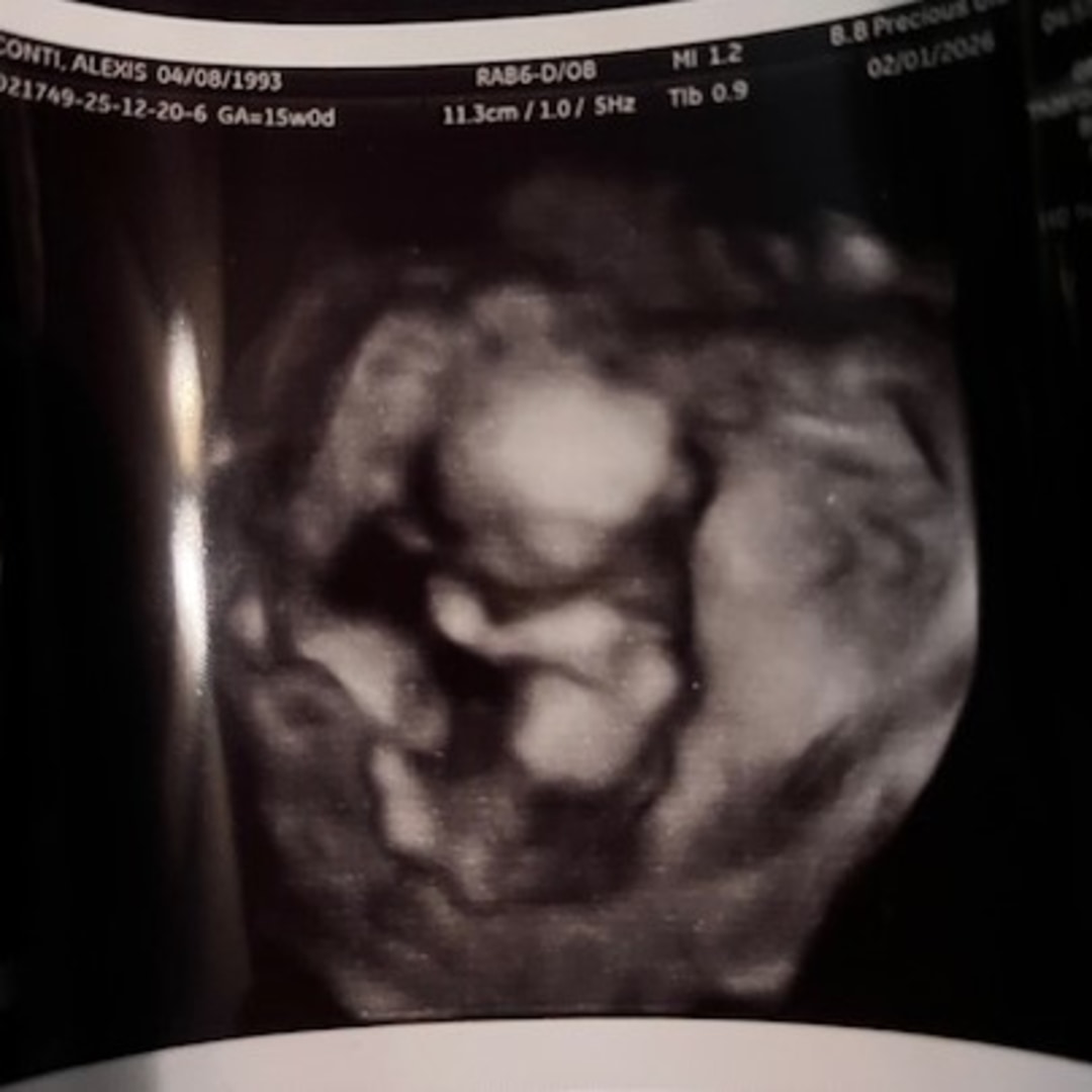 Photo shared by Alexis for their Babylist baby registry.