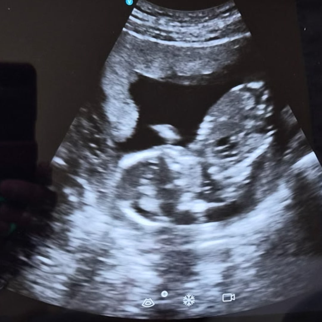 Photo shared by Jacelyn for their Babylist baby registry.