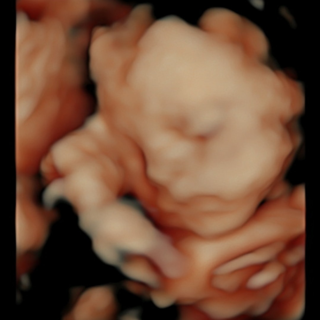 Photo shared by Maegan for their Babylist baby registry.