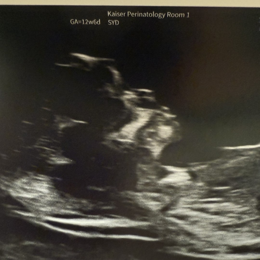 Photo shared by Amanda for their Babylist baby registry.