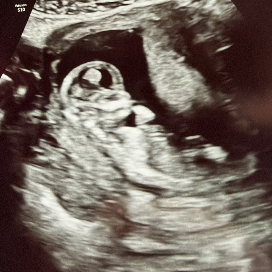 Photo shared by Emma for their Babylist baby registry.