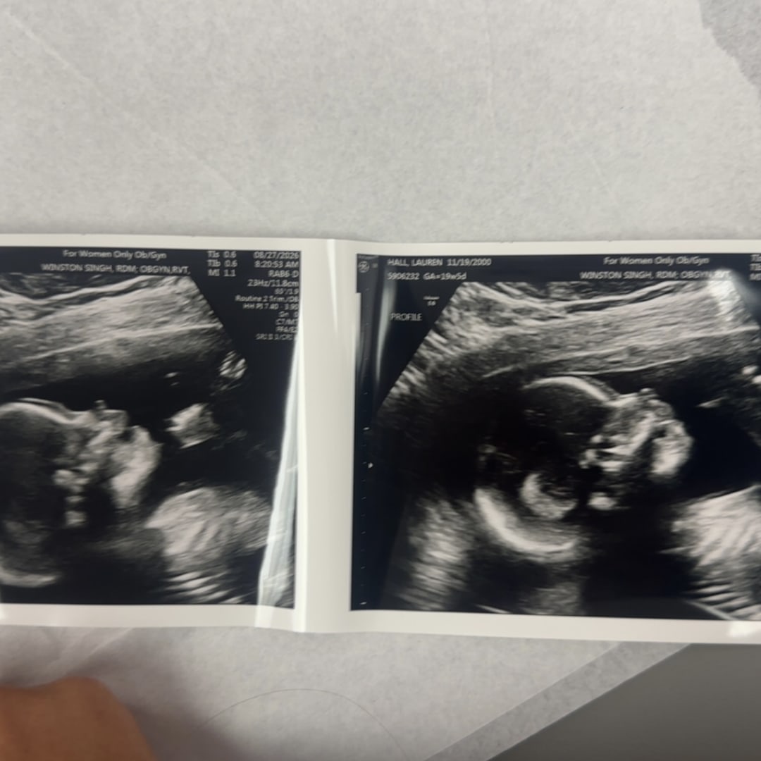 Photo shared by Lauren for their Babylist baby registry.