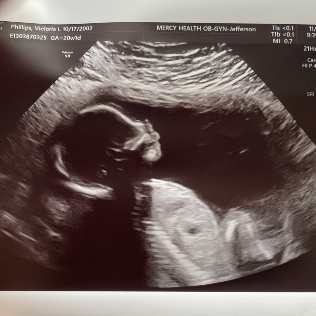 Photo shared by Victoria for their Babylist baby registry.