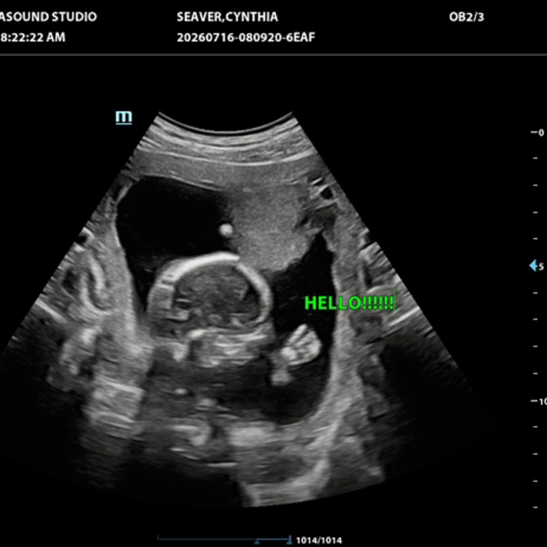 Photo shared by Cynthia for their Babylist baby registry.
