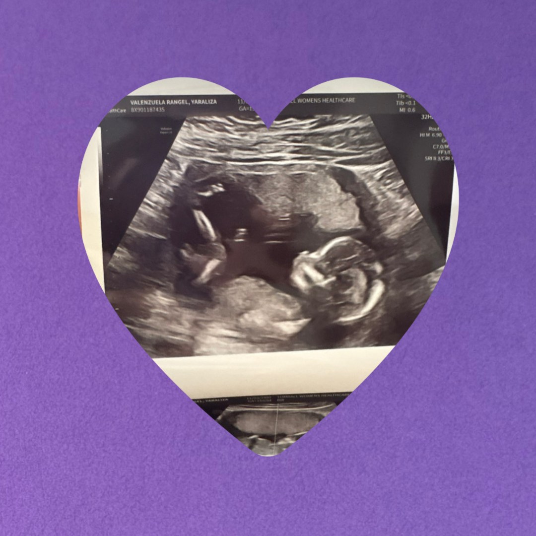 Photo shared by Yara for their Babylist baby registry.